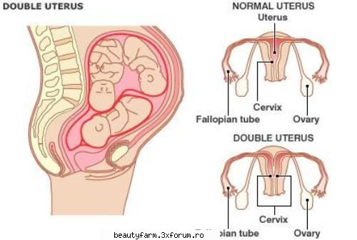 femeia doua utere nascut gemeni botezata womber woman (un fel femeia americane care i-au