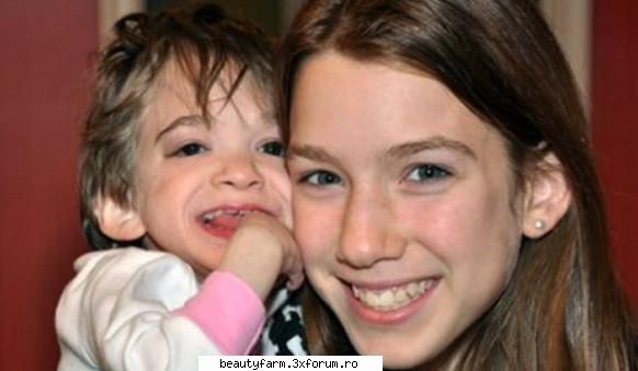 Adolescenta care nu imbatraneste niciodata - Brooke Greenberg este fiica in varsta de 16 ani a - SANATATE