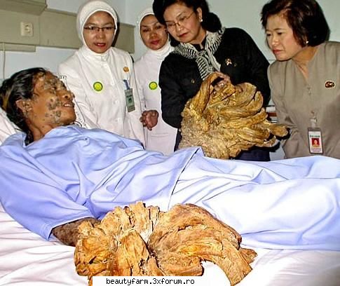 doctorul armand gaspari de la din maryland este de parere ca boala de piele de care sufera �omul