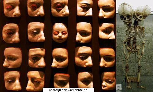 10. muzeul de istorie medicala m�tter 

a fost fondat in anul 1858, in orasul din statul american de