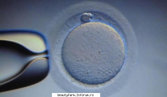 Traficul de ovule � businessul secolului XXI - �America este tara tuturor posibilitatilor�. O - COOL STUFF